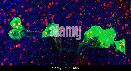 In uno studio sulle mosche, gli scienziati NIH hanno dimostrato come il sistema immunitario possa essere un colpevole dei danni causati dall'invecchiamento dei disturbi cerebrali. Ulteriori informazioni:. Foto Stock