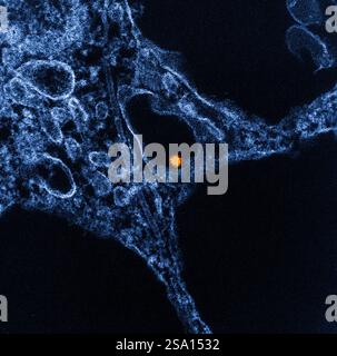 Micrografia elettronica a trasmissione colorata di una particella del virus del Nilo occidentale (giallo/rosso) trovata all'interno del citoplasma di una cellula VERO E6 (blu). Foto Stock