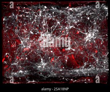 Cellule vascolari e neuroni che producono dopamina del cervello umano, entrambi generati da un paziente cellule staminali nel Brain-Chip per la ricerca sulla malattia di Parkinsons. Il Brain-Chip è stato sviluppato a Cedars-Sinai in collaborazione con emulate, Inc. Una vista dall'alto verso il basso del cervello e dei canali vascolari di un chip cerebrale colorato mostra che le cellule microcapillari del cervello rosse interagiscono con neuroni dopaminici bianchi. Qui, il chip cerebrale è stato colorato con la molecola di trasporto del glucosio-1 GLUT1, necessaria per l'assorbimento del glucosio dal sangue, e la tirosina idrossilasi TH, un enzima chiave nella produzione di dopamina. Brai Foto Stock