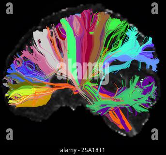 Questa immagine di diffusione ad alta risoluzione angolare HARDI del cervello umano mostra connessioni a lunga distanza, o tratti, raggruppati in base al loro quartiere anatomico. I cablaggi associati a particolari strutture cerebrali condividono lo stesso colore. Nell'imaging di diffusione, lo scanner rileva il movimento dell'acqua all'interno delle fibre neurali per rivelarne la posizione. Questa immagine si basa sui dati HCP della prima fase dello scanner MGH/Harvard/UCLA Connectom. I ricercatori sperano di utilizzare la stessa tecnica per analizzare i dati di un progetto relativo alla seconda fase di HCPï½s che esaminerà le connessioni negli adolescenti con i mentali Foto Stock