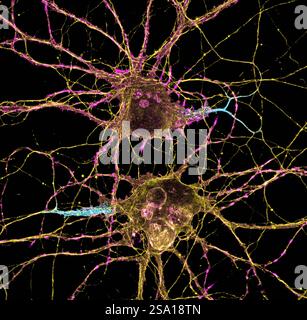 Gli scienziati hanno sviluppato nuovi strumenti sorprendenti per esplorare i circuiti neurali che sono alla base della funzione cerebrale durante i primi cinque anni del National Institutes of Healths Brain Research attraverso la promozione di innovative Neurotechnologies BRAIN Initiative. Ora, il NIH ha annunciato il suo continuo sostegno a questi progetti finanziando oltre 180 nuovi premi BRAIN Initiative, portando il budget totale 2019 per il programma a oltre 424 milioni di dollari. Neuroni 016555 027 Foto Stock