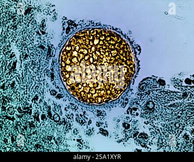 Una sfera micotica di Coccidioides gialla trovata in un campione di tessuto. Questo organismo provoca la coccidioidomicosi, nota anche come febbre della valle. Credito: Micrografia di colorazione CDC ed effetti visivi di NIAID. Febbre della valle/Coccidioides fungine sferule 016931 040 Foto Stock