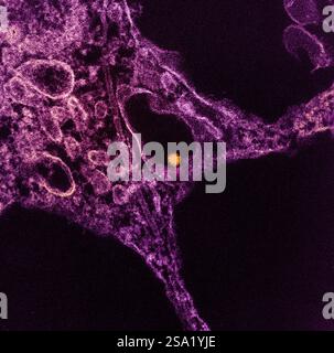 Micrografia elettronica a trasmissione colorata di una particella arancione del virus del Nilo occidentale trovata all'interno del citoplasma di un magenta cellulare VERO E6. Immagine acquisita presso l'Integrated Research Facility in ft. Detrick, Maryland. Credito: NIAID. Virus del Nilo occidentale 016931 062 Foto Stock