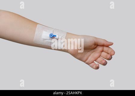 Concetto di medicina. Catetere periferico per la terapia di più giorni Foto Stock