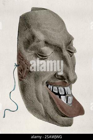 Francia. La rivoluzione del 1830. Maschera satirica del monarca Carlo X di Francia. Caricatura del tempo. xix secolo. Foto Stock