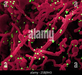 Micrografia elettronica a scansione colorata di una cellula (rossa) infettata da particelle virali SARS-CoV-2 (verde), isolata da un campione paziente. Foto Stock