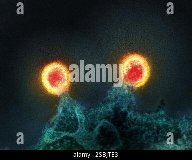 Micrografia elettronica a trasmissione colorata di due particelle del virus HIV-1 (rosso/giallo) che fuoriescono dalla membrana plasmatica di una cellula H9 T infetta (verde acqua). Immagine acquisita presso il NIAID Integrated Research Facility (IRF) di Fort Detrick, Maryland. Foto Stock