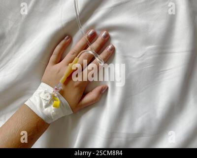 Terapia endovenosa. Flebo IV ospedaliero e catetere periferico per la terapia di più giorni. Concetto di medicina. Foto Stock