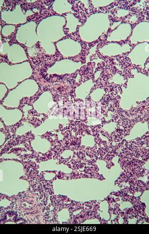 Polmoni al microscopio 100x Foto Stock