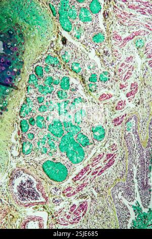 Tessuto polmonare con asma al microscopio Foto Stock