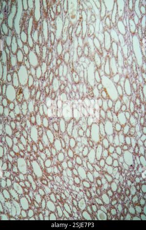 Tessuto polmonare sano sotto il microscopio 100x Foto Stock