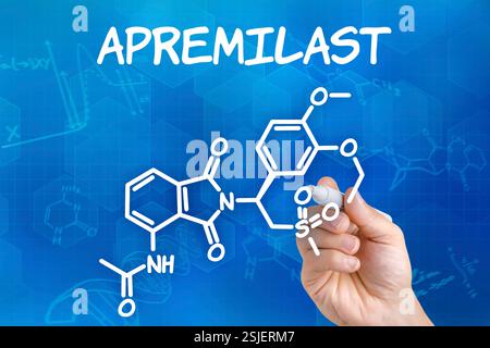 Mano con matita disegna la formula chimica strutturale di Apremilast Foto Stock