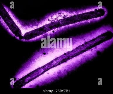 Atlanta, Stati Uniti. 20 dicembre 2024. Tre influenza A - H5N1, particelle del virus dell'influenza aviaria colorate viola per il rilevamento sullo sfondo in un microscopio elettronico presso la sede del CDC, 20 dicembre 2024 ad Atlanta, Georgia. Credito: CDC/NIAID/Alamy Live News Foto Stock