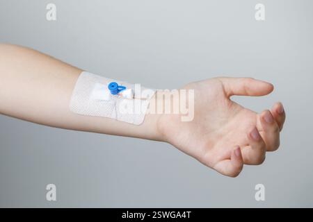 Catetere periferico lungo per la terapia di più giorni sulla mano umana Foto Stock