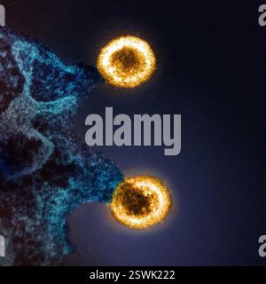 Micrografia elettronica a trasmissione colorata di due particelle del virus HIV-1 (gialle) che fuoriescono dalla membrana plasmatica di una cellula H9 T infetta (blu). Immagine acquisita presso il NIAID Integrated Research Facility (IRF) di Fort Detrick, Maryland. Foto Stock