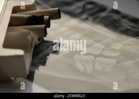 Sigarette giacciono su una radiografia dentale panoramica, carie di nicotina, denti cattivi fumatori Foto Stock