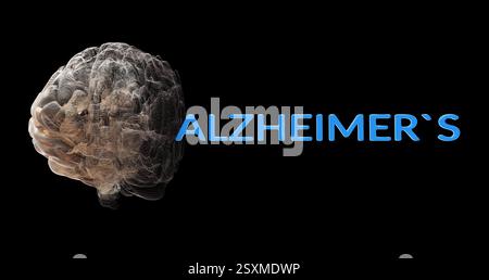 Deterioramento del modello cerebrale con il testo "ALZHEIMER", raffigurante la condizione neurodegenerativa e la perdita di memoria. Foto Stock