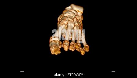 Foot 3D Scan for diagnosis foot diseases by CT-SCANNER . Foto Stock