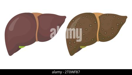 Icona del fegato umano isolata su sfondo bianco. Illustrazione vettoriale. EPS 10. Illustrazione Vettoriale