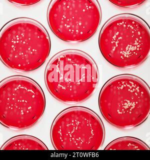 Capsule di Petri con agar sangue rosso contenente colonie di Staphylococcus aureus Foto Stock