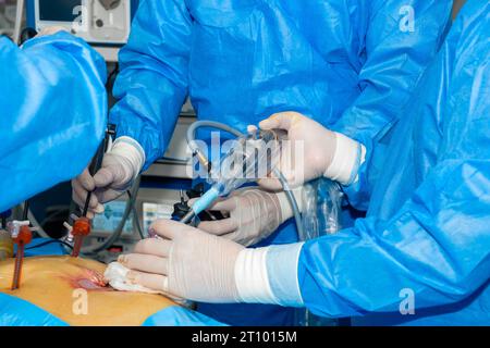 Un team di medici esegue un intervento laparoscopico in sala operatoria. Le mani dei chirurghi trattengono manipolatori chirurgici per interventi endoscopici minimamente invasivi con effetto luminoso. Foto Stock