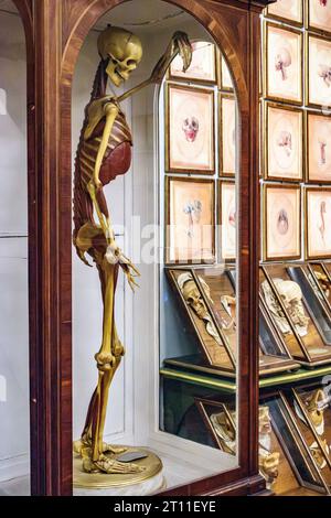 Il museo noto come la Specola, a Firenze, fondato nel 1775, contiene modelli anatomici di cera altamente accurati di corpi dissezionati per l'insegnamento della medicina Foto Stock