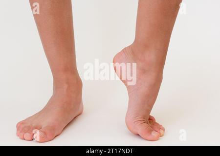 Gambe per bambini tagliate con tacchi sollevati Foto Stock