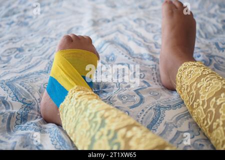 Nastro elastico terapeutico giallo e blu applicato alla gamba del bambino. Foto Stock