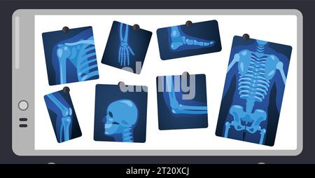 Raggi X sullo schermo medico. Parti scheletro umano su chirurgia light pad, parti del corpo concetto radiografico medico. Illustrazione vettoriale Illustrazione Vettoriale