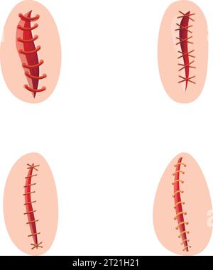 Le icone della sutura chirurgica impostano il vettore cartoon. Vari tipi di sutura operativa. Chirurgia, concetto sanitario Illustrazione Vettoriale