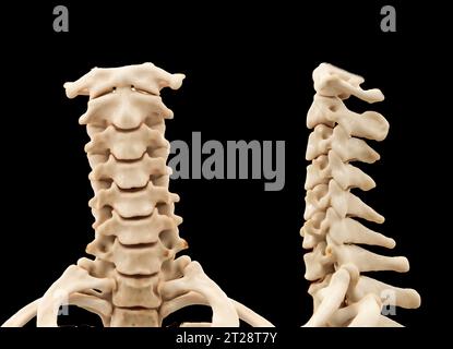 Scansione TC della colonna cervicale o del rendering 3D della colonna cervicale per la diagnosi di frattura della colonna cervicale in caso di trauma. Foto Stock