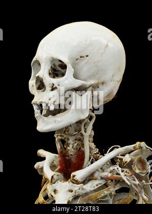 CTA cervello e arteria carotide o angiografia TC del cervello 3D immagine di rendering . Foto Stock