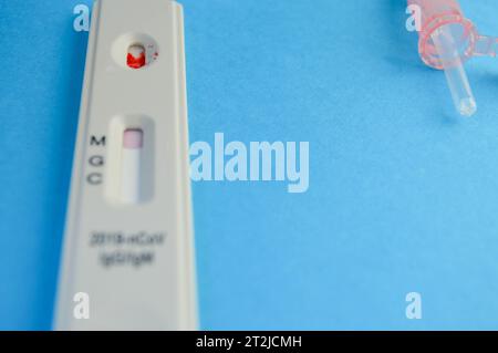 Campione di sangue su cassetta RDT Rapid Diagnostic REST, tecnico medico che esegue il test rapido PRP del sangue identificando gli anticorpi per Coronavirus S. Foto Stock