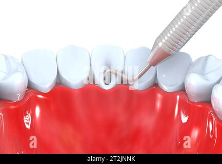 Pulizia professionale dei denti. rendering 3d. Foto Stock