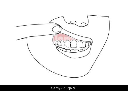 donna bocca orale malattia dentale gomma arrossata linea di malattia art Illustrazione Vettoriale