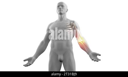 illustrazione in 3d di un'anatomia umana con dolore al gomito Foto Stock