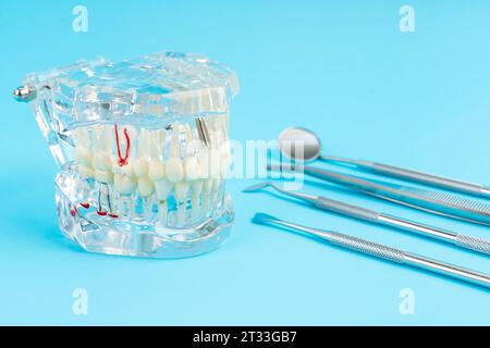 Modello di protesi mascellari o acriliche con impianti e attrezzi dentali su sfondo blu. Foto Stock