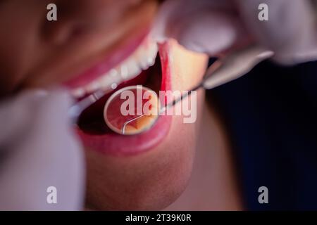 23 ottobre 2023, Renania settentrionale-Vestfalia, Mönchengladbach: Il dentista Dr. Kranz usa uno specchio per guardare i denti di un paziente nel suo studio dentistico. Foto: Rolf Vennenbernd/dpa Foto Stock