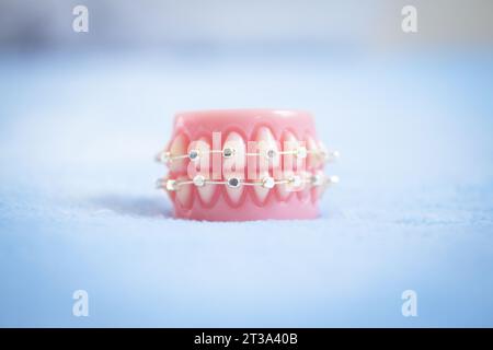 Base per dentiera ortodontica in metallo. Nessuna gente Foto Stock