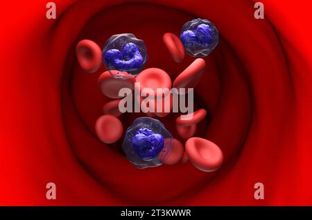 Leucemia mielogena cronica (LMC) nel flusso sanguigno - vista in sezione illustrazione 3d. Foto Stock