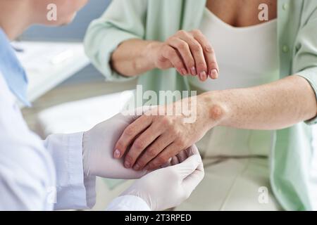 Primo piano del medico che ispeziona l'eruzione cutanea a mano di una paziente di sesso femminile in clinica dermatologica, spazio copia Foto Stock