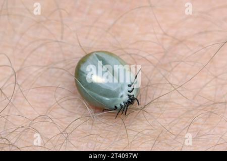 Zecca di fagiolo di ricino (Ixodes ricinus) femmina ingorgo di sangue sulla pelle umana può causare la malattia di Lyme e l'encefalite da zecche Foto Stock