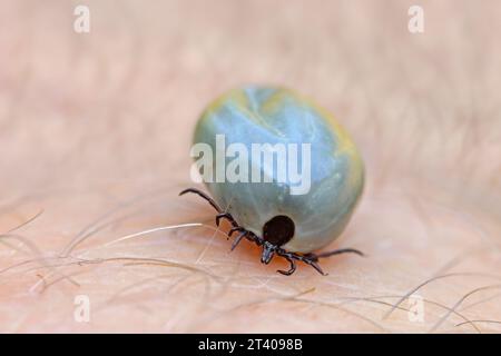 Zecca di fagiolo di ricino (Ixodes ricinus) femmina ingorgo di sangue sulla pelle umana può causare la malattia di Lyme e l'encefalite da zecche Foto Stock