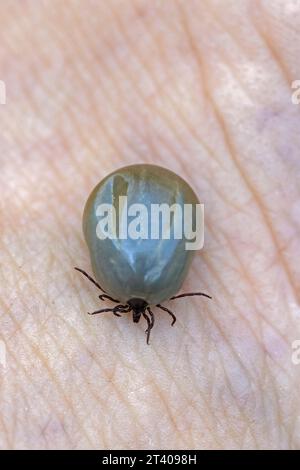 Zecca di fagiolo di ricino (Ixodes ricinus) femmina ingorgo di sangue sulla pelle umana può causare la malattia di Lyme e l'encefalite da zecche Foto Stock