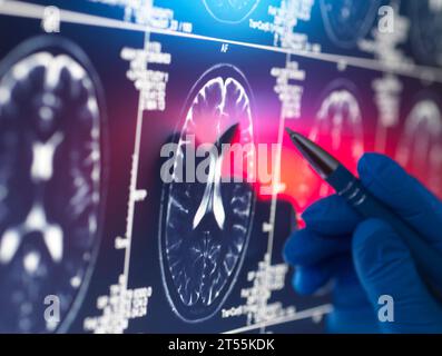 Medico che visualizza una scansione cerebrale del paziente sullo schermo Foto Stock