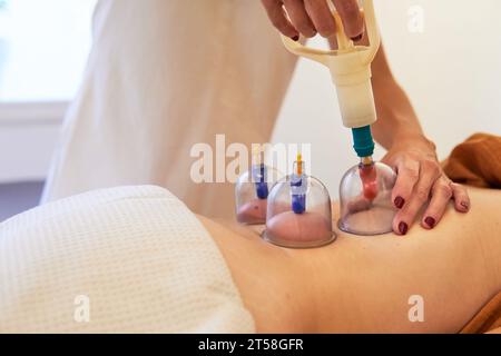 Praticante che esegue la terapia di coppettazione sotto vuoto con pistola pompante sul retro di una donna Foto Stock