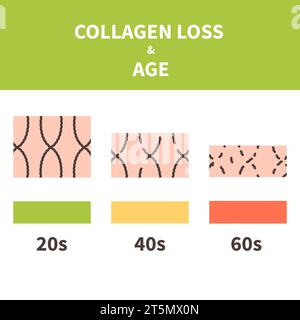 Infografica sulla perdita di collagene e sull'invecchiamento della pelle Illustrazione Vettoriale