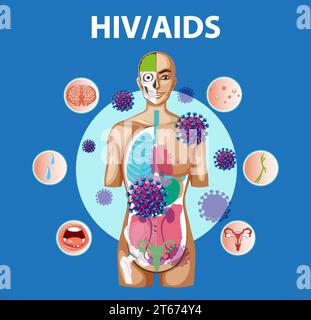 Illustrazione che illustra l'impatto dell'HIV/AIDS sul corpo umano Illustrazione Vettoriale