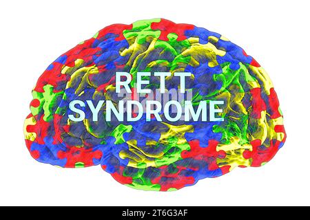 Text Rett Syndrome all'interno del modello anatomico di un cervello umano, con un puzzle pattern colorato sulla sua superficie, evidenziando le basi neurologiche di Foto Stock