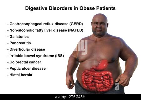 Una dettagliata illustrazione medica 3D di un uomo in sovrappeso con pelle trasparente, rivelando il sistema digestivo ed evidenziando i problemi digestivi Foto Stock